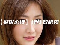 【整形必读】埋线双眼皮的那些事儿（关于埋线双眼皮的问题）
