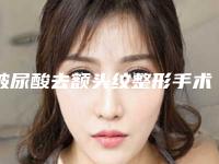 玻尿酸去额头纹整形手术的效果特点「玻尿酸去额头纹用什么方法效果最好」