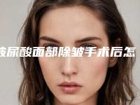 玻尿酸面部除皱手术后怎么达到好的效果