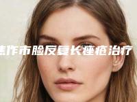 焦作市脸反复长痤疮治疗价格(价目)2025洗心革面(脸反复长痤疮治疗均价为：2359元)
