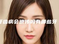 牙齿病会遗传吗有哪些牙齿疾病会遗传