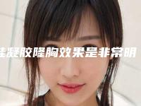 硅凝胶隆胸效果是非常明显的 让我们超级让人心动火辣性感