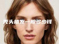 秃头植发一般多少钱