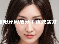 绵阳牙周洁牙手术效果才最好