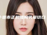 十堰市正规隆胸乳晕切口医院-十堰淑梅医学整形美容诊所技术优势出炉