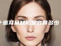 十堰耳朵缺陷整容得多少费用