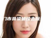 厦门市鼻梁皱纹去除多少钱(2025年厦门市鼻梁皱纹去除价格表一览全新版本)