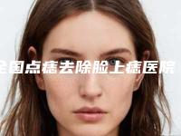 全国点痣去除脸上痣医院哪家强：点痣去除脸上痣医院分享_50强热门医院信息一览