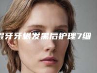 假牙牙根发黑后护理7细节