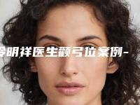 冷明祥医生颧弓位案例-价格收费表详细医生完整曝光一览