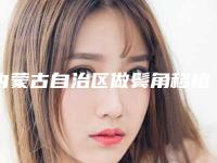 内蒙古自治区做鬓角移植医生来啦-内蒙古自治区做鬓角移植医生