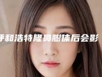 呼和浩特隆鼻膨体后会影响出汗吗