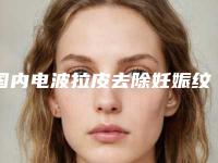 国内电波拉皮去除妊娠纹医院排名：电波拉皮去除妊娠纹医院50强入围详情