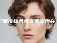 三明市钛合金支架义齿在榜名单前10久负盛名-三明市钛合金支架义齿口腔医生