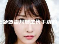 上颌智齿颊侧生长手术的适应人群主要有哪些