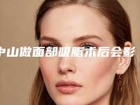 中山做面部吸脂术后会影响怀孕吗