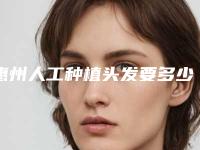 惠州人工种植头发要多少的费用