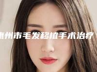 惠州市毛发移植手术治疗谢顶价格表(费用)项目详细一览(毛发移植手术治疗谢顶手术价格贵不贵呢)