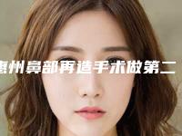 惠州鼻部再造手术做第二次有效吗适合哪些人群