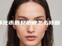怀化市唇裂疤痕怎么修复医院排行榜十强哪些技术强-怀化德美整形成功入围