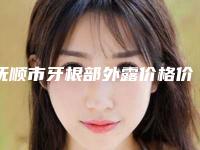 抚顺市牙根部外露价格价位表，2025近期更新-抚顺市牙根部外露价格