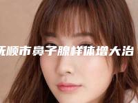 抚顺市鼻子腺样体增大治疗整形医院(艾尚美医疗美容整形技术不错)
