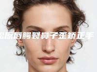 松原唇腭裂鼻子歪矫正手术是否真的安全