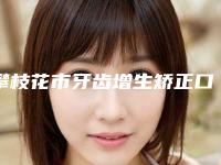 攀枝花市牙齿增生矫正口腔医生排行榜有失败吗-攀枝花市牙齿增生矫正医生稳居前三