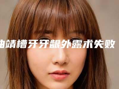 曲靖槽牙牙龈外露术失败修复安不安全