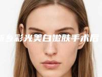新乡彩光美白嫩肤手术后二期修复多少钱