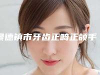 景德镇市牙齿正畸正颌手术医院排行名单出炉（Smartee正雅旗舰店景德镇美阳口腔优质医美价格公道）