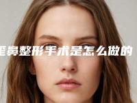 歪鼻整形手术是怎么做的要多少钱（歪鼻子矫正手术多少钱）