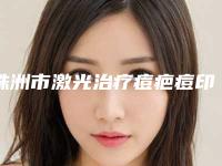 株洲市激光治疗痘疤痘印价格(2025年株洲市激光治疗痘疤痘印费用表明细公布2025)