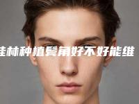 桂林种植鬓角好不好能维持多久