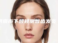 济南市下颌颊侧智齿发炎治疗医院排名第一(济南维乐口腔门诊超全合集)