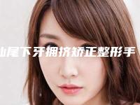 汕尾下牙拥挤矫正整形手术比较适合哪些人做
