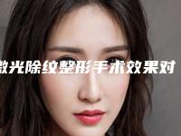 激光除纹整形手术效果对比,激光除纹整形手术的效果好不好