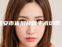 淮安市雀斑样痣手术切除医生在榜清单前十强实力大推荐-淮安市雀斑样痣手术切除医生