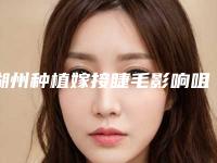 湖州种植嫁接睫毛影响咀嚼功能吗