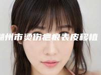 湖州市烫伤疤痕表皮移植手术价格表(费用)详尽曝出(烫伤疤痕表皮移植手术均价为：6106元)