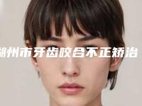 湖州市牙齿咬合不正矫治医院排行榜技术口碑突出（湖州市牙齿咬合不正矫治口腔医院包揽前四强）