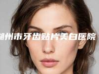 湖州市牙齿贴片美白医院排名榜前10名最新发布（湖州市牙齿贴片美白口腔医院医疗实力可赞）