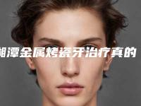 湘潭金属烤瓷牙治疗真的没有副作用么「湘潭金属烤瓷牙手术会不会有什么副作用」