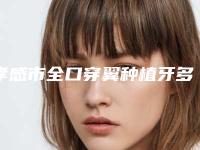 孝感市全口穿翼种植牙多少钱-孝感市全口穿翼种植牙医院排行榜TOP10强各个口碑佳
