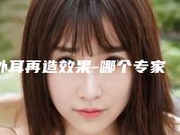 外耳再造效果-哪个专家外耳再造修复做得好