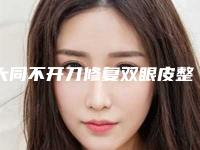 大同不开刀修复双眼皮整形手术安全不