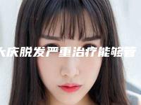 大庆脱发严重治疗能够管多久「大庆脱发严重治疗后可保持多少年」