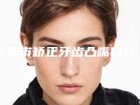 太原市矫正牙齿凸嘴口腔医生在榜清单top10强这些不容错过-苏曼医生收费标准并不高