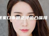 张家口市矫正牙齿凸嘴排行榜前十名实力贴发布-张家口市矫正牙齿凸嘴口腔医生