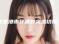 张家港市牙槽骨突出切除术医院上榜名单实力评比（张家港市牙槽骨突出切除术口腔医院实力口碑过硬）